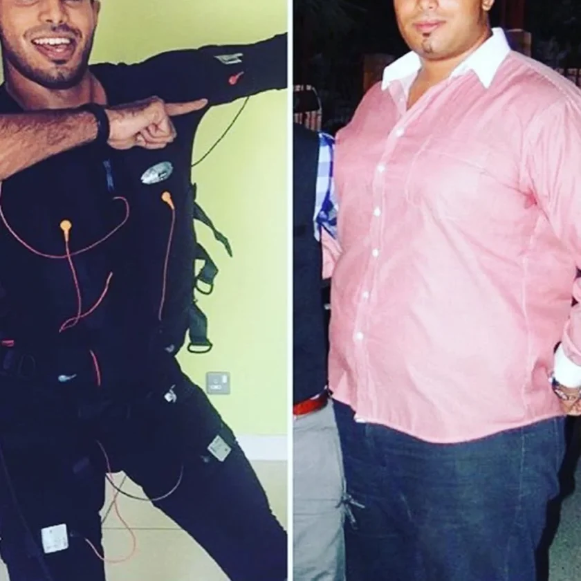 Before-After-EMS-Dubai